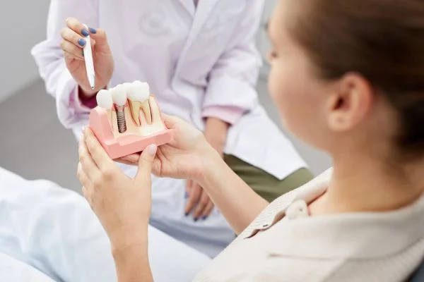 A model of a dental implant in Stephenville TX