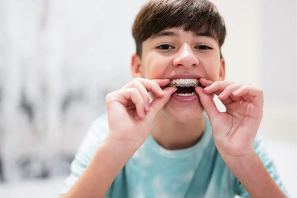 A pair of Invisalign clear aligners in Stephenville TX