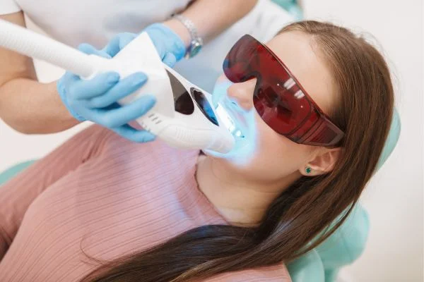 Professional teeth whitening at Dental Excellence in Stephenville, TX